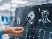 Doctor reviewing a brain scan on a screen with a patient, representing an AI stroke tool that helps spot blood clots more quickly so treatment can start sooner.